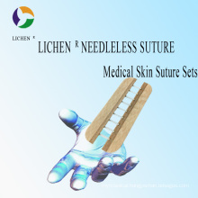 Medical Skin Suture Equipment for The Size 140mm